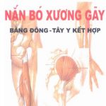 Nắn Bó Xương Gãy Bằng Đông Tay Y Kết Hợp - Nguyễn Hải Ngọc